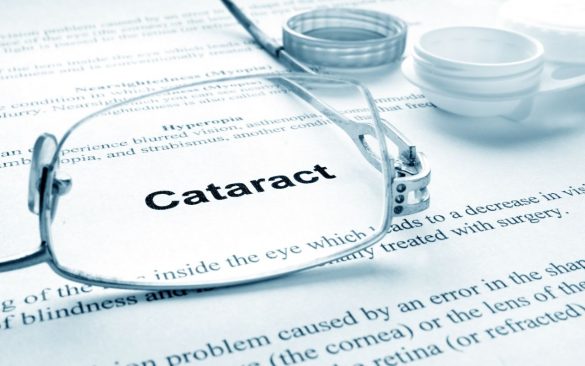 Surgical Treatment of Cataracts